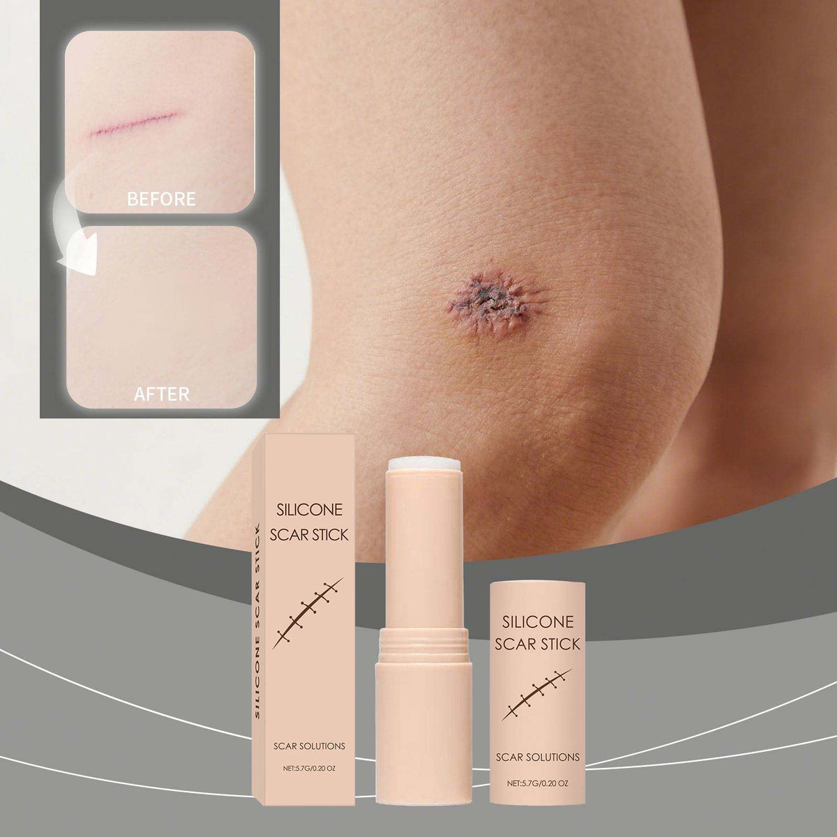 Silicon Scar Removal Stick
